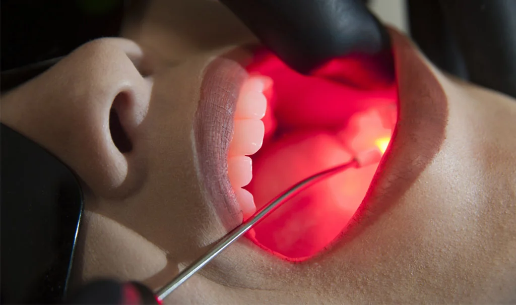 Laserterapia Odontológica Clínica